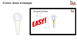 Crown down Technique ENDODONTICS [upl. by Getter]