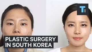 Plastic surgery in South Korea [upl. by Teriann]