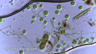 Pond Scum Under the Microscope [upl. by Inesita]