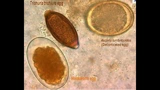 parasites seen from the microscope [upl. by Ellives583]