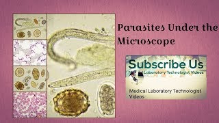 Parasites Under The Microscope [upl. by Immas638]