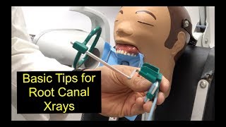 Basic Tips for Root Canal Xrays [upl. by Oiralih]