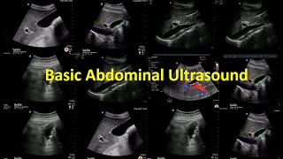 1 ABC Abdominal Ultrasound  Ahmed Morad [upl. by Suanne102]