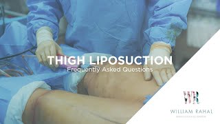 Thigh Liposuction Recovery amp other FAQs Frequently Asked Questions [upl. by Ahsenet]