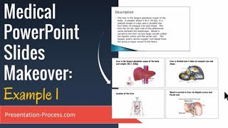 Medical PowerPoint Slides Makeover Example 1 [upl. by Denna848]