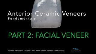 Anterior Ceramic Veneers Part 2 Facial Veneer [upl. by Fesuy244]