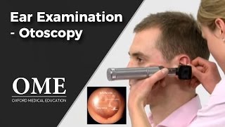 Otoscopy Ear Examination  ENT [upl. by Leunad]