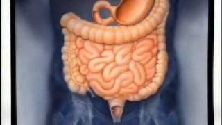 Achalasia What You Should Know [upl. by Llerruj]