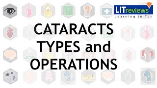 What to Expect After CATARACT SURGERY [upl. by Elfrida666]