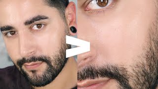 How I Shrunk My Pores  Smaller tighter Clearer Pores ✖ James Welsh [upl. by Leacock]