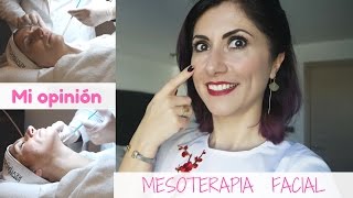 Mesoterapia Facial  Mi experiencia [upl. by Laemsi284]