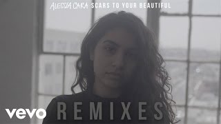 Alessia Cara  Scars To Your Beautiful Joe Mason Remix  Official Audio [upl. by Reine]