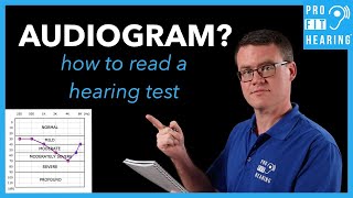 Audiogram  How to Read a Hearing Test [upl. by Eilzel]