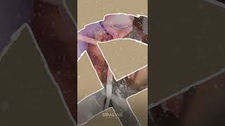 Opaline Patient Reel 01 [upl. by Cha]