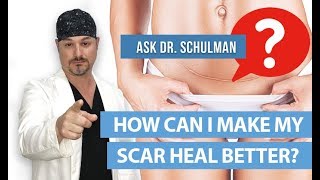 How Can I Make My Scar Heal Better  Ask Dr Schulman [upl. by Shayla]