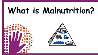 What is Malnutrition [upl. by Wettam]