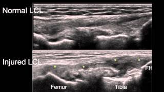 Anatomy of the Knee Joint [upl. by Guerin260]