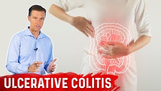 DIY Fecal Transplants to cure yourself of Ulcerative Colitis [upl. by Rramed265]