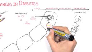 Diabetes Complication and Pathophysiology of the complication [upl. by Neumeyer]