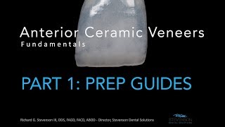 Anterior Ceramic Veneers Part 1 Preparation Guides [upl. by Leoine]