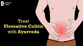 Common mistakes in the treatment of severe ulcerative colitis [upl. by Peony]