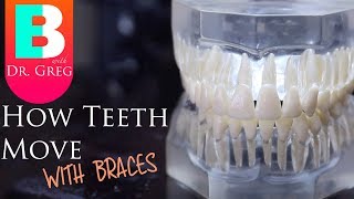 BRACES EXPLAINED How Teeth Move  Braces Work [upl. by Honor]