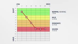 Hearcom  How to Read an Audiogram [upl. by Massiw]