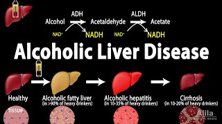 Alcoholic Liver Disease Animation [upl. by Yecats]