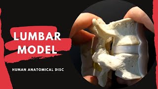 Lumbar Spine Anatomy Model  with Ligamentum Flavum and Interspinous Ligament [upl. by Ojahtnamas]