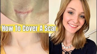 How To Cover A Scar or Surgical Incision [upl. by Kyl]