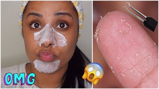 DIY Pore Strips Get Rid of BlackheadsWhiteheads  EASY [upl. by Anauqahs]