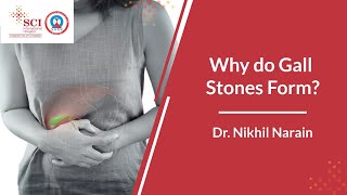 What are Gallstones Causes Symptoms  Treatment of Gallstone [upl. by Darleen]