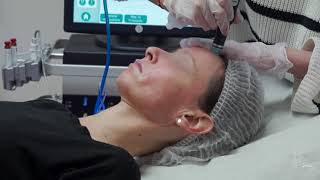 Hydrafacial  la séance complète de nettoyage de peau [upl. by Reffineg]