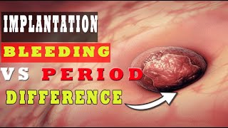 Implantation Bleeding Vs Period – How to Know the Difference 🩸🩸 [upl. by Brieta]