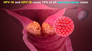 Human Papillomavirus HPV [upl. by Zysk780]