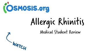 Allergic Rhinitis  Clinical Presentation [upl. by Asik943]