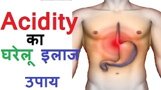 जानिए एसिडिटी के घरेलू उपाय ईलाज़  Acidity Ka Gharelu Ilaj │ Health Tips Gyan Hindi [upl. by Nosrak241]