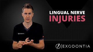 LINGUAL NERVE INJURIES IN DENTISTRY  OnlineExodontiacom [upl. by Nivak]